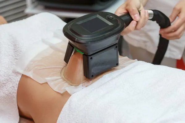 Image of person having fat freezing treatment to help weight gain Beaconsfield