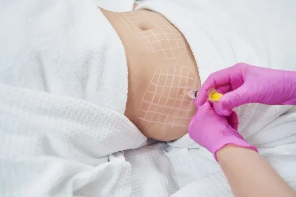 image of fat dissolving injections on love handles to help combat weight gain Beaconsfield