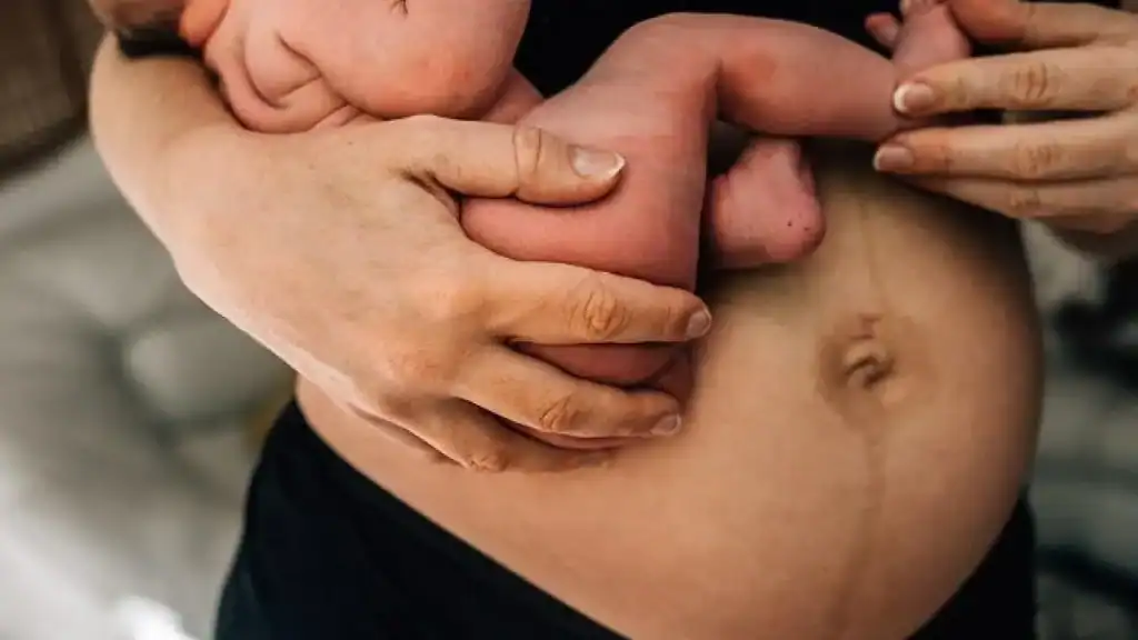 Why Is My Stomach Still Big After Pregnancy Beaconsfield?