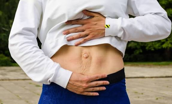 When Could Diastasis Recti Be the Missing Piece of the Puzzle Beaconsfield?